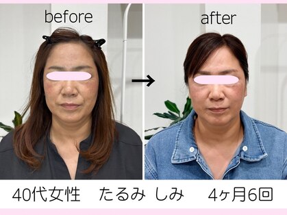美容整体 ソワンの写真