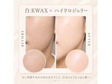 ブリエ(Briller)の雰囲気(最新ケアでつるん白玉肌。角質オフで明るさ実感)