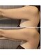 ワイケー(yk)の写真/脂肪撃退♪脅威の40%☆高濃度溶解液使用!なかなか減らない憎き脂肪とお別れしましょう♪ダウンタイムなし!