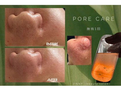 ジーニー(JINNY)の写真
