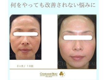 パーソナルデトックスサロン エヌ(N)/違和感なし自然なエイジングケア