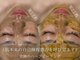 セレソル(CERESOL)の写真