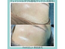 パリスエリー(PARIS ELLY)の雰囲気（全ての毛質に対応☆ダブル脱毛併用サロン【顔ワックス】）