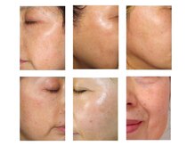 アリアサンティエ(Alia Scintiller)/大人の肌悩みが明確にでてきたら