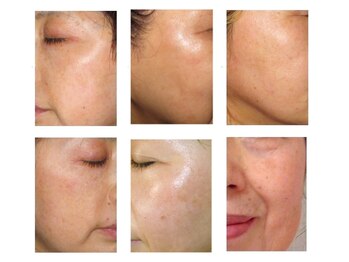 アリアサンティエ(Alia Scintiller)/大人の肌悩みが明確にでてきたら