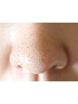 毛穴ケアをしたい