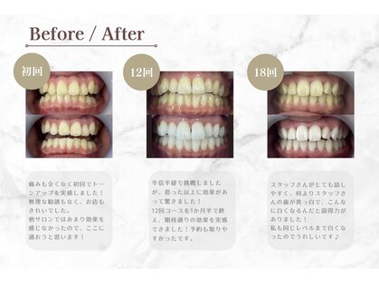 ホワイトニングバー 大宮店の写真