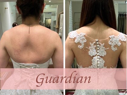 ガーディアン(Guardian)の写真