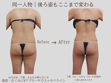 プレリー 自由が丘店/後ろ姿もここまで変わる