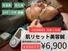 初回限定【たるみ/むくみ改善】肌の土台から整える美容鍼60分¥11,000→¥6,900