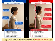 笑う門 新小岩店/猫背・巻き肩の姿勢ケア