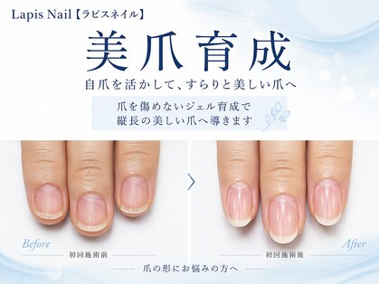 ラピスネイル(Lapis Nail)の写真