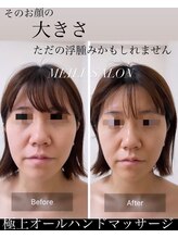 メイリー(MEILI)/極上小顔リンパマッサージ