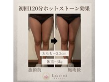 ラクシュミー(Lakshmi)の雰囲気（痩身効果大！脂肪燃焼で冷え性改善と痩身効果の一石二鳥！）