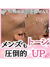 ホワイトワックス 名古屋金山店(WHITE WAX)/メンズも圧倒的トーンアップ