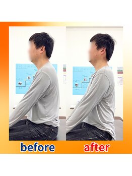 ストレッチヒーロー 福山神辺店/ビフォーアフター【1回の変化】