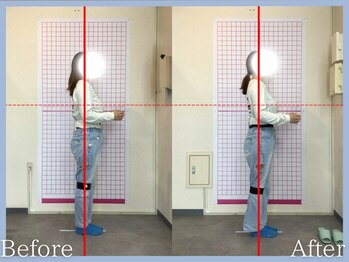 トロ整骨院(toro整骨院)/★骨格矯正(1回)★産後30代女性