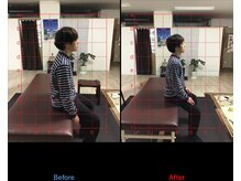 ストレチックス 近江八幡店/肩甲骨周りのコリ、腰の痛み撃退