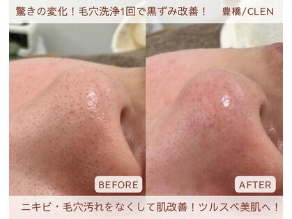 クレン(CLEN)の写真