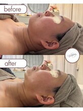 ヴィオルネ(VIE ORNER)/