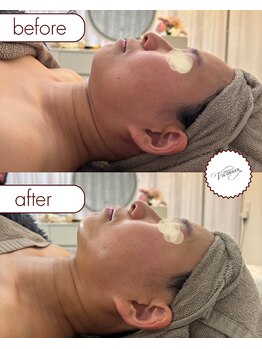 ヴィオルネ(VIE ORNER)/