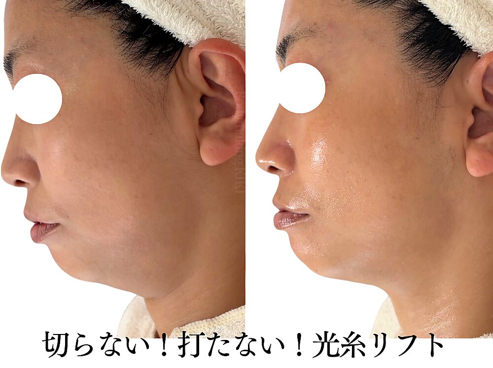 ボディメイキング キキ(Bodymaking KIKI)｜ホットペッパービューティー