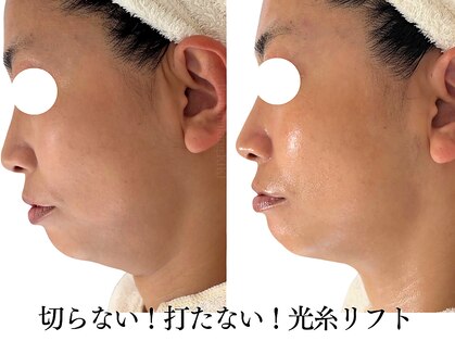 ボディメイキング キキ(Bodymaking KIKI)の写真