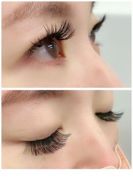 ナチュレ 荒井店(NATURE)/MIXメニュー60分