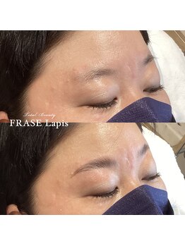 フレイズラピス(FRASE Lapis)/【ハリウッドブロウリフト】
