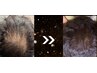 【頭皮ケアで細くなった髪に】ポテンツァ+NNプラセンタ導入　60分￥22,000⇒