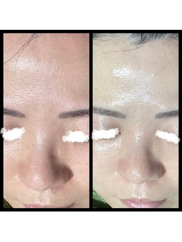 ココスタイルビューティー(COCOSTYLE beauty)/ララピール