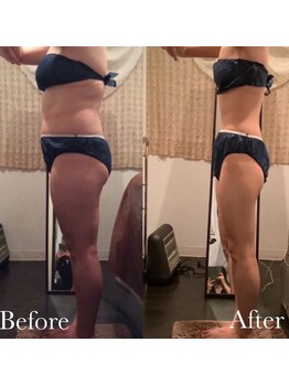 ケイカ 下北沢(KEIKA)/お客様のbefore⇒after