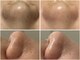 ベル(Belle)の写真/【最先端の技術導入！毛穴洗浄】毛穴の黒ずみ・ザラつき・開き・くすみ・乾燥等、お肌の悩みを徹底改善！