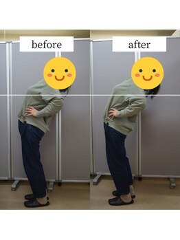 アップルミント/＜リンパ整体＞before・after