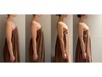 ロココ 豊田店(Rococo)/ビフォーアフター