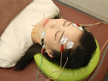 かんざき鍼灸接骨院/美容鍼/20本/電流リフト