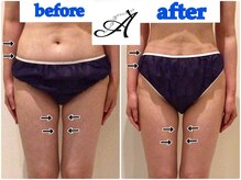 アデアネックス(ADE ANNEX)