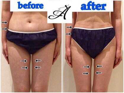 アデアネックス(ADE ANNEX)の写真