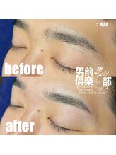 男前倶楽部/脱毛/メンズ脱毛/メンズ専門店