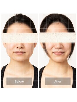 ミミ トータルケア(mimi Total care)の写真/たるみの根本原因は”神経”にあった!!20年超オーナーが神経から本来の小顔を引き出し、最高の夏を演出☆