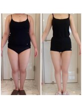 耳つぼアンドスリムケア イヤローブ(Earlobe)/結婚式に向けてダイエット！