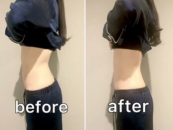 サンク(Cinq)/【整体+骨盤矯正】腰痛改善