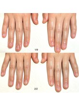 リンク(LINK)/お爪の変化