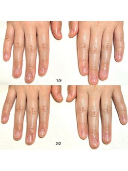 リンク(LINK)/お爪の変化