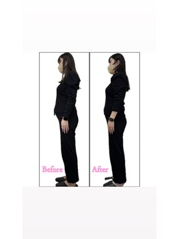 宮町鍼灸整骨院/妊娠中の腰痛にマタニティケア