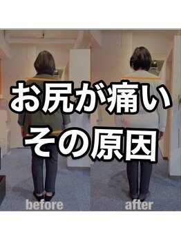 カワル整体 上通り院/お尻が痛い、その原因