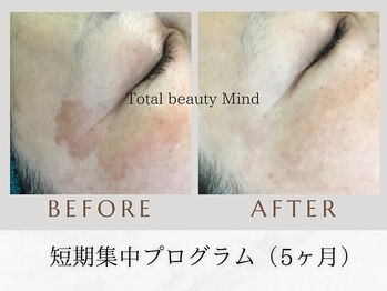 トータルビューティー マインド(Total Beauty)/プログラム（5ヶ月）