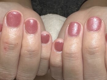 プラスワン(+1)/即見た目改善(3)アフター