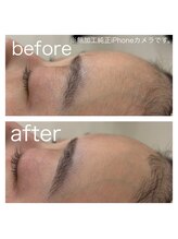 ラクシー 御徒町(luxssy)/フェイスシェービング