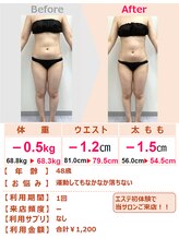 スリムステーション 高槻駅前(Slim Station)/エステ初体験で大満足！